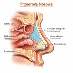 Operacja przegrody nosowej - kiedy warto ją wykonać